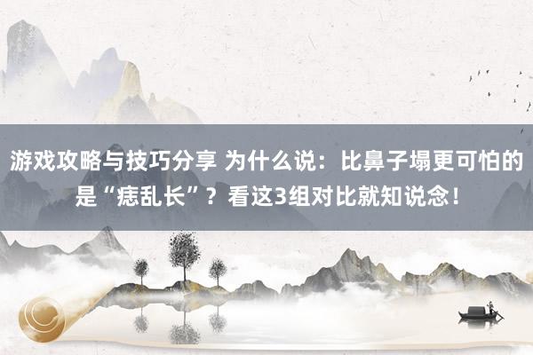 游戏攻略与技巧分享 为什么说：比鼻子塌更可怕的是“痣乱长”？看这3组对比就知说念！